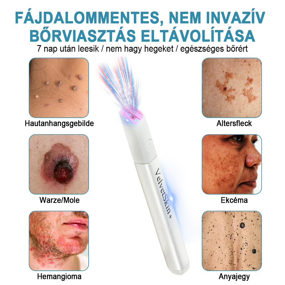 ✨ Bikenda®  – Laserowy Długopis CO₂ do Usuwania 🟤 Znamion, 🦠 Brodawek, 🔘 Przebarwień i Innych Niedoskonałości Skóry)🧿