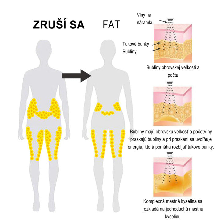 ✨🩵2024 Legújabb 𝐑𝐢𝐧𝐡𝐫𝐧𝐧™ Ultrahangos Detox zsírégető-Energy Balance karkötő⏱️ (70% kedvezmény az elmúlt napokban + orvos ajánlása)