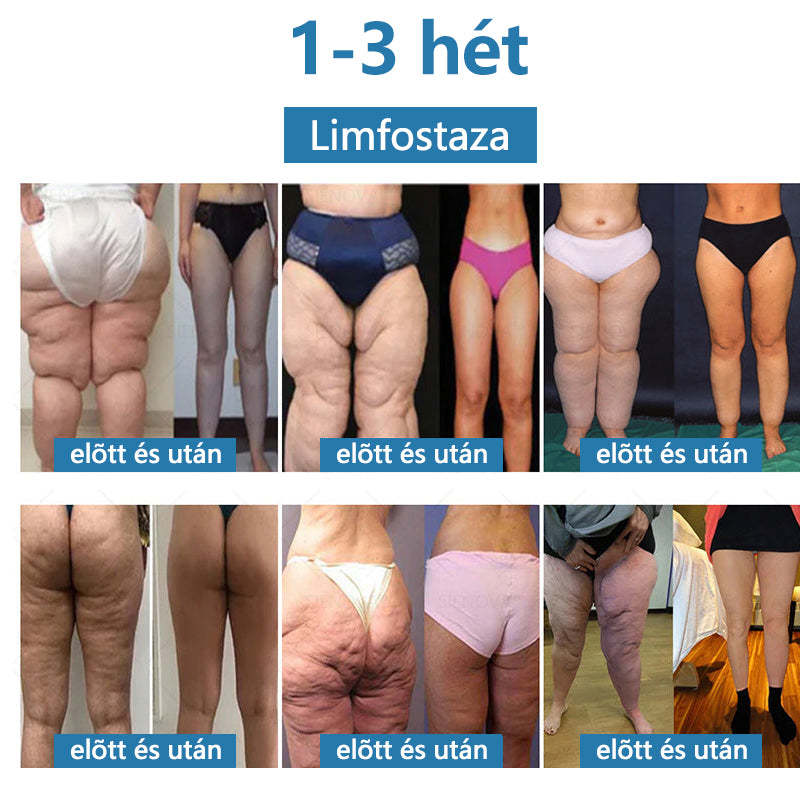 SIENOVA™💎 Hordozható nyirokeltető és ízületi relaxációs készülék👨⚕️ Eredeti 2 az 1-ben terápia | OGYEI minősített