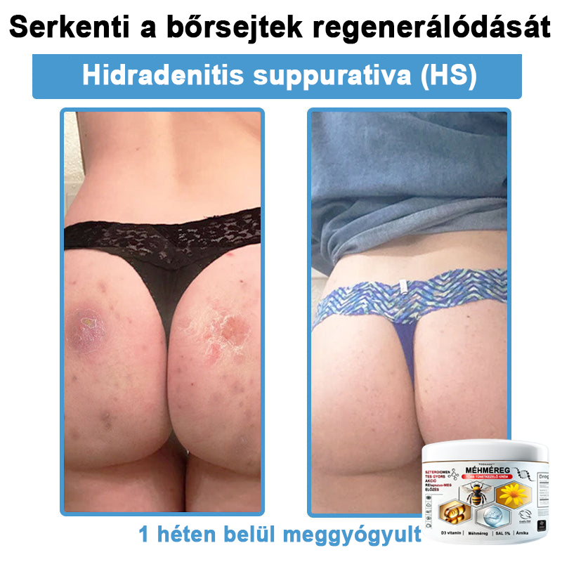 TODAHOF™✨ Multi-Symptoms krém méhméreggel (👩⚕️ az EMA ajánlásával)