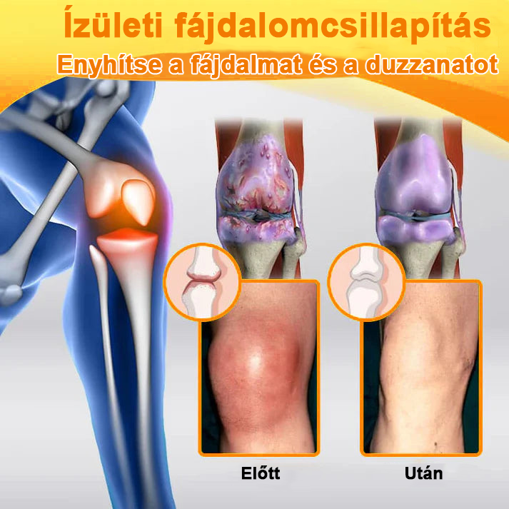 ✅Hivatalos Áruház: Ourlyard™ Magnézium Olaj és Méhméreg ízületjavító spray 👨⚕️ A Gyógyszerügyi Hivatal (OGYEI) jóváhagyásával🔥🔥🔥