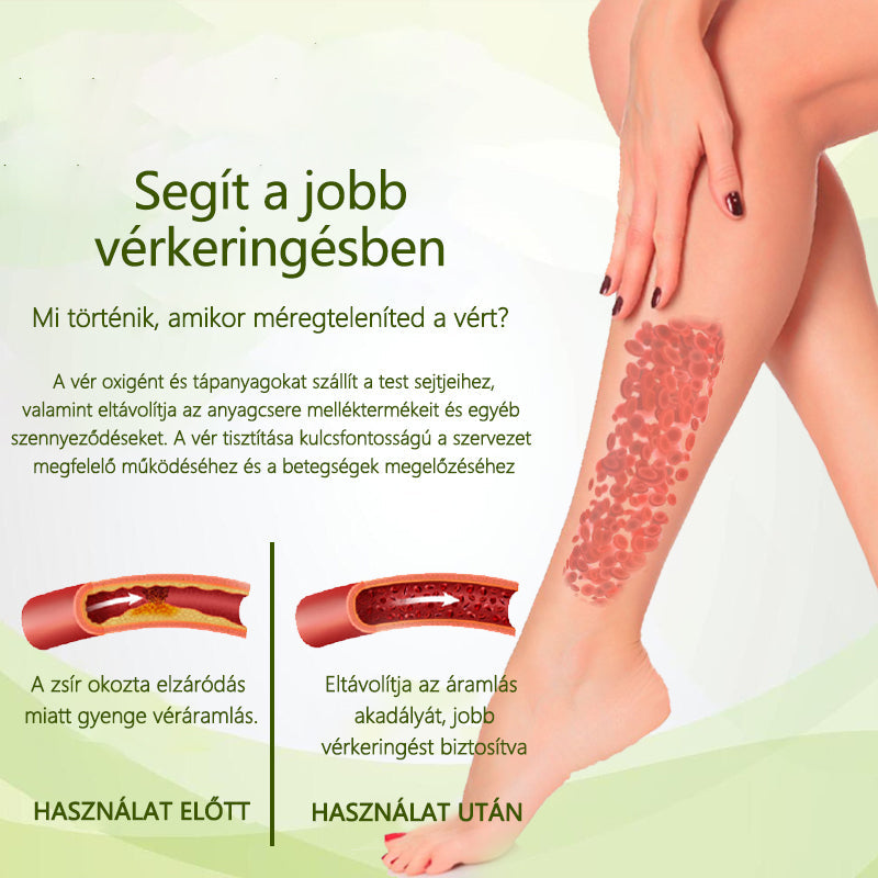 Croaie® SwellFree Mondj búcsút a duzzadt lábaknak és a visszér okozta kellemetlenségeknek – Természetesen!✅