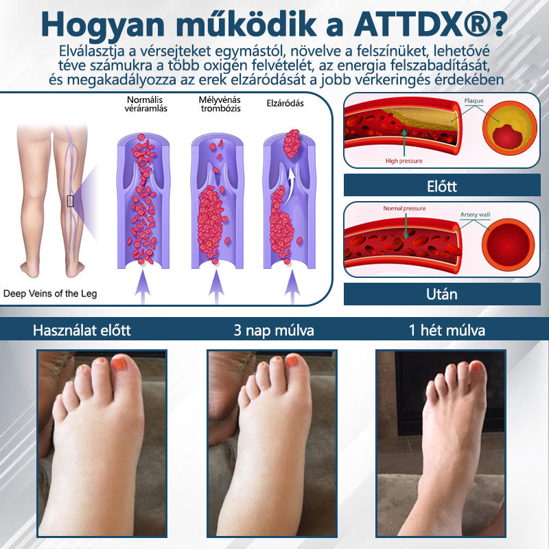 💧ATTDX® Növényi ödéma enyhítő krém nigellával