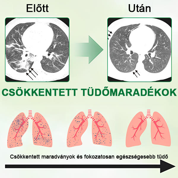 đăđKĂ©szĂŒlt Ă©s szĂĄllĂtott az EgyesĂŒlt KirĂĄlysĂĄgbanâ
ăđšââïžđđđđđđÂź Lung JavĂtĂł Ă©s ĂĄpolĂł inhalĂĄtorok (đTĂŒdĆszakĂ©rtĆ ajĂĄnlottđ)