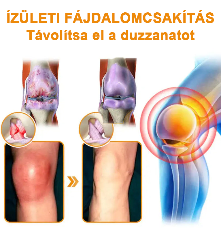 ✅Hivatalos Áruház: Ourlyard™ Magnézium Olaj és Méhméreg ízületjavító spray 👨⚕️ A Gyógyszerügyi Hivatal (OGYEI) jóváhagyásával🔥🔥🔥