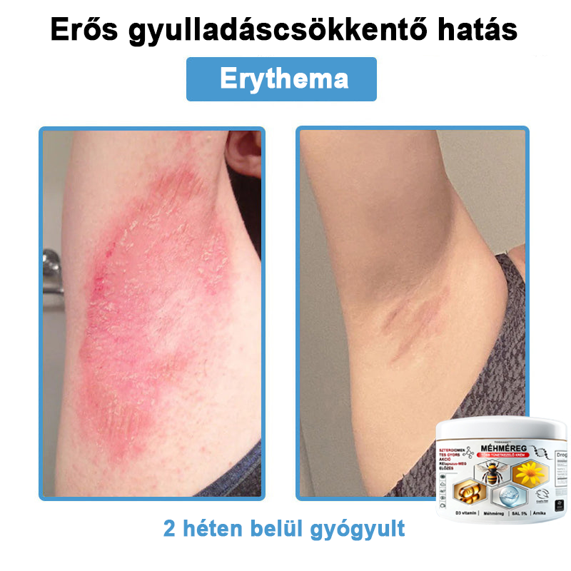 TODAHOF™✨ Multi-Symptoms krém méhméreggel (👩⚕️ az EMA ajánlásával)