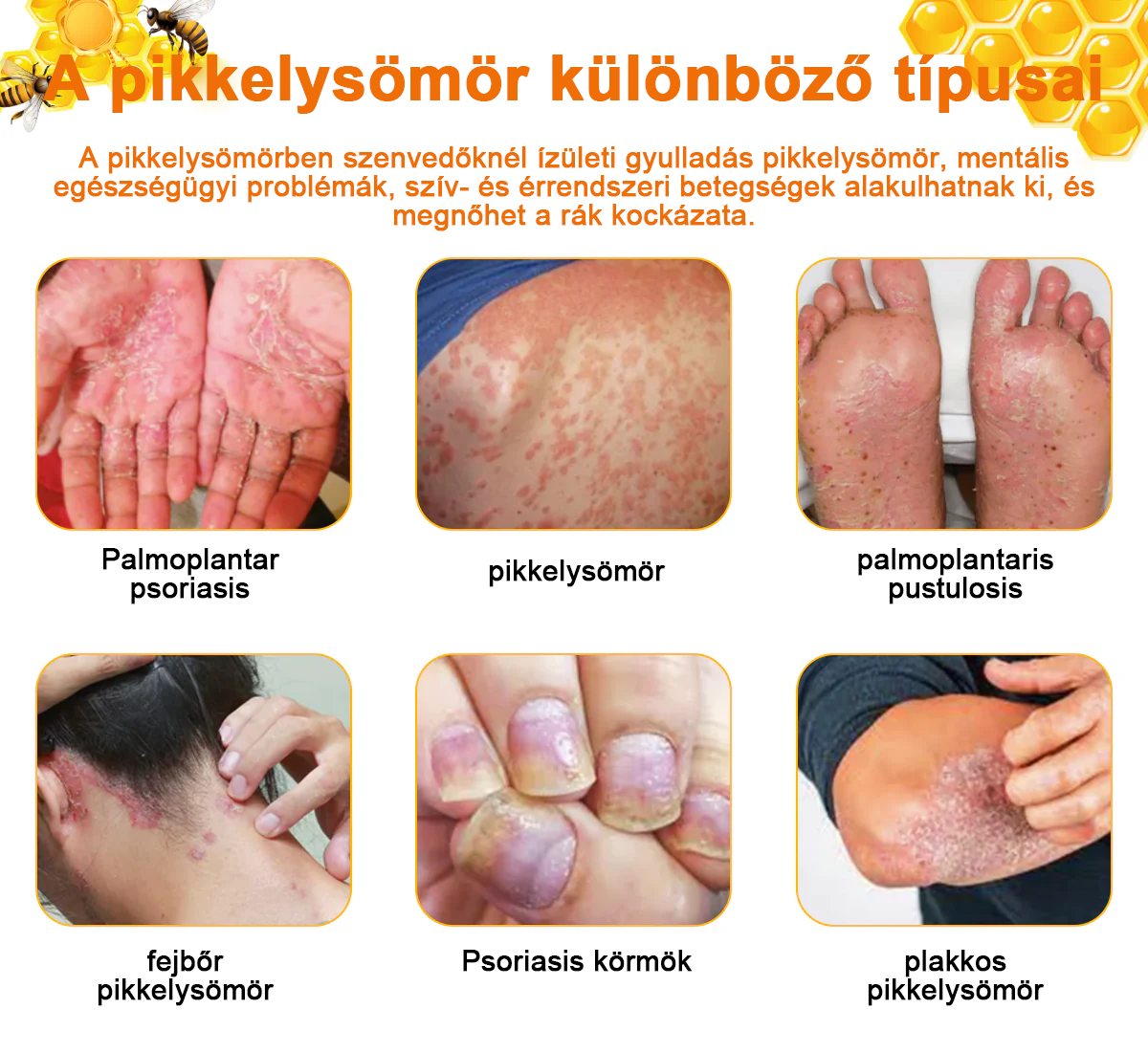 đ©ââïžđZoencgzâą mĂ©hmĂ©reg pikkelysömör eltĂĄvolĂtĂł krĂ©mđ„ (Az SSDV Skin Institute ajĂĄnlĂĄsa)