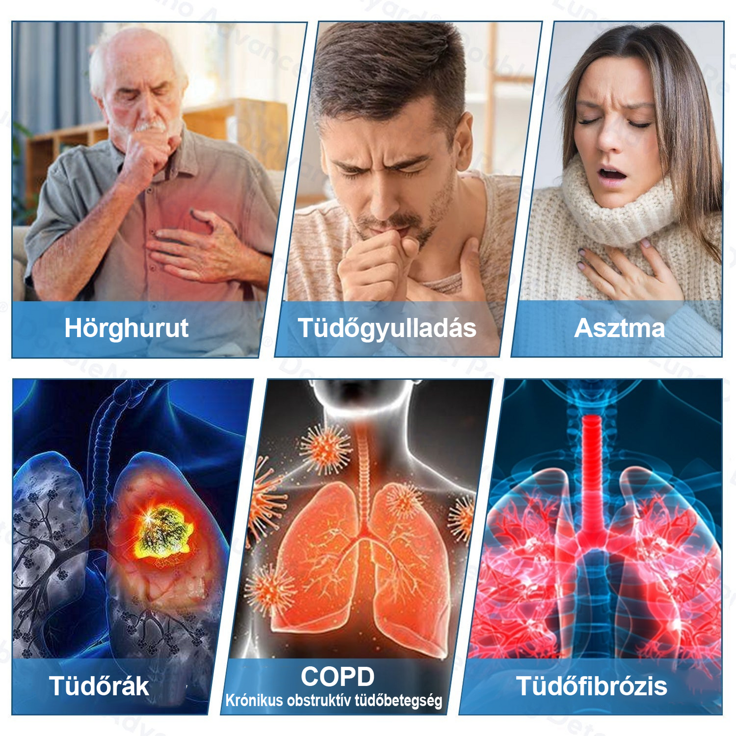 🛡️🛡️FDA Jóváhagyott | Zvoevo®  COPD Enyhítő Tapasz (💝 Köhögés, zihálás, légszomj, köpet, orrdugulás, hörghurut, allergiás tünetek, tüdő kényelmetlenség🫁)