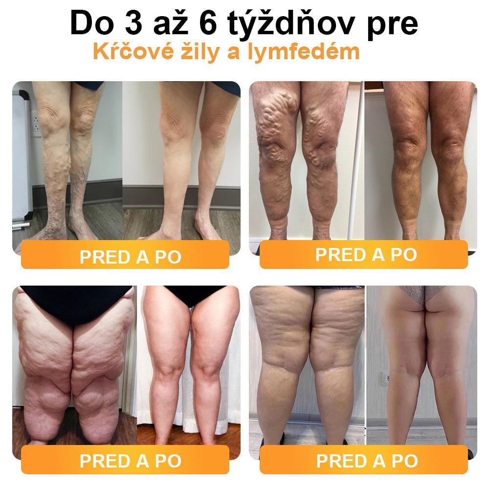 ✨🩵2024 Legújabb 𝐑𝐢𝐧𝐡𝐫𝐧𝐧™ Ultrahangos Detox zsírégető-Energy Balance karkötő⏱️ (70% kedvezmény az elmúlt napokban + orvos ajánlása)