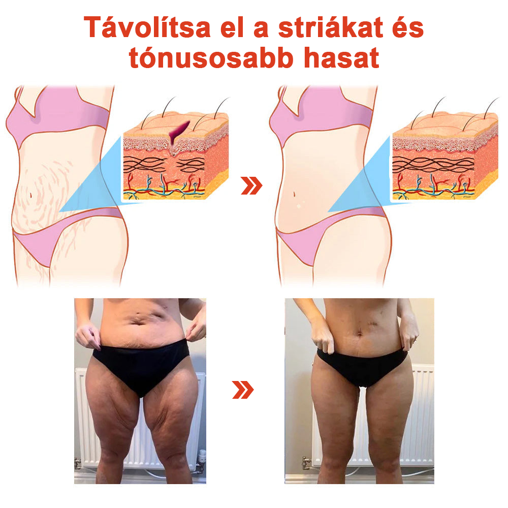 STDEI™ MÁGIKUS LUXUS TESTOLAJ (Korlátozott ideig 80% kedvezmény - Utolsó 30 perc)🌹🔥