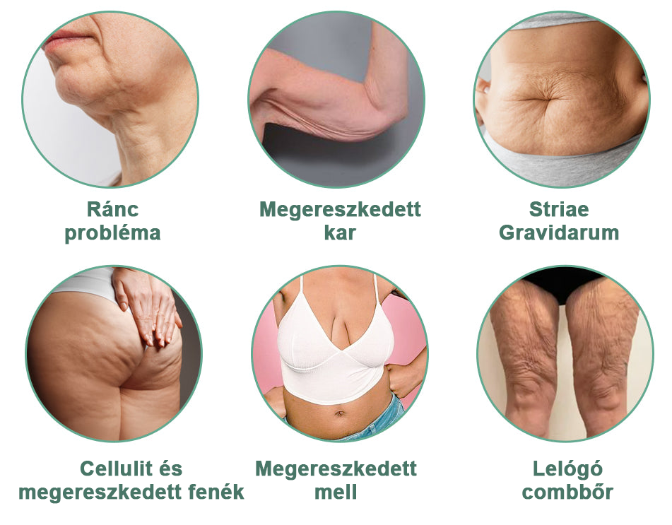 💃🧑⚕️Utolsó napi kedvezmény: 75% 0FF Ceoerty™advanced feszesítő és ránctalanító krém: visszaállítja a bőr rugalmasságát🌐