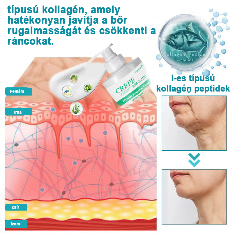 đđ„łFlysmusâą rĂĄnctalanĂtĂł krĂ©m, kreppelĂ©s Ă©s megereszkedĂ©s (đ„74% kedvezmĂ©ny korlĂĄtozott ideig!)