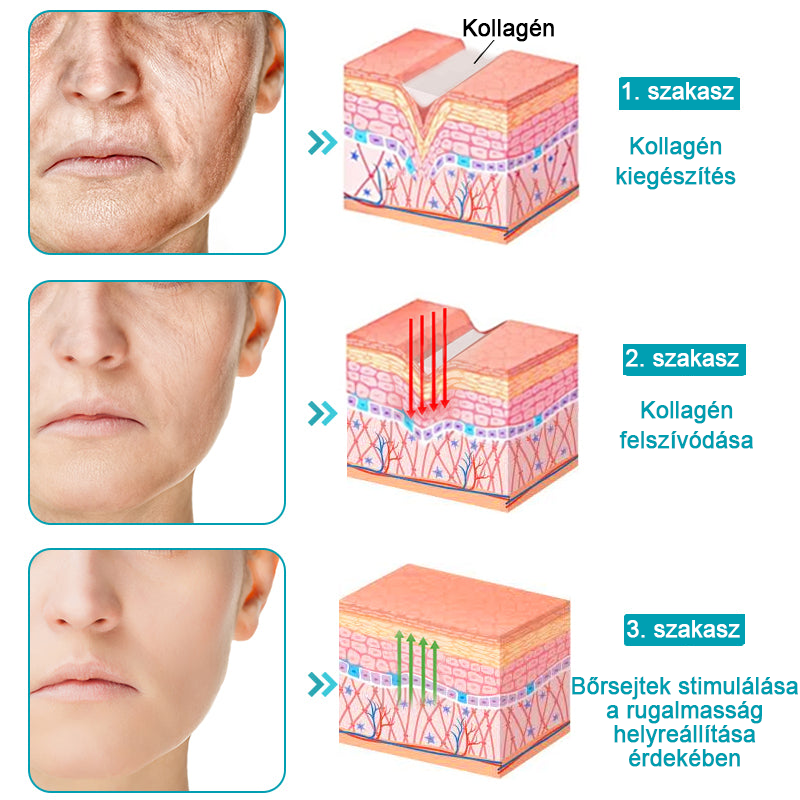 đđ„łFlysmusâą rĂĄnctalanĂtĂł krĂ©m, kreppelĂ©s Ă©s megereszkedĂ©s (đ„74% kedvezmĂ©ny korlĂĄtozott ideig!)