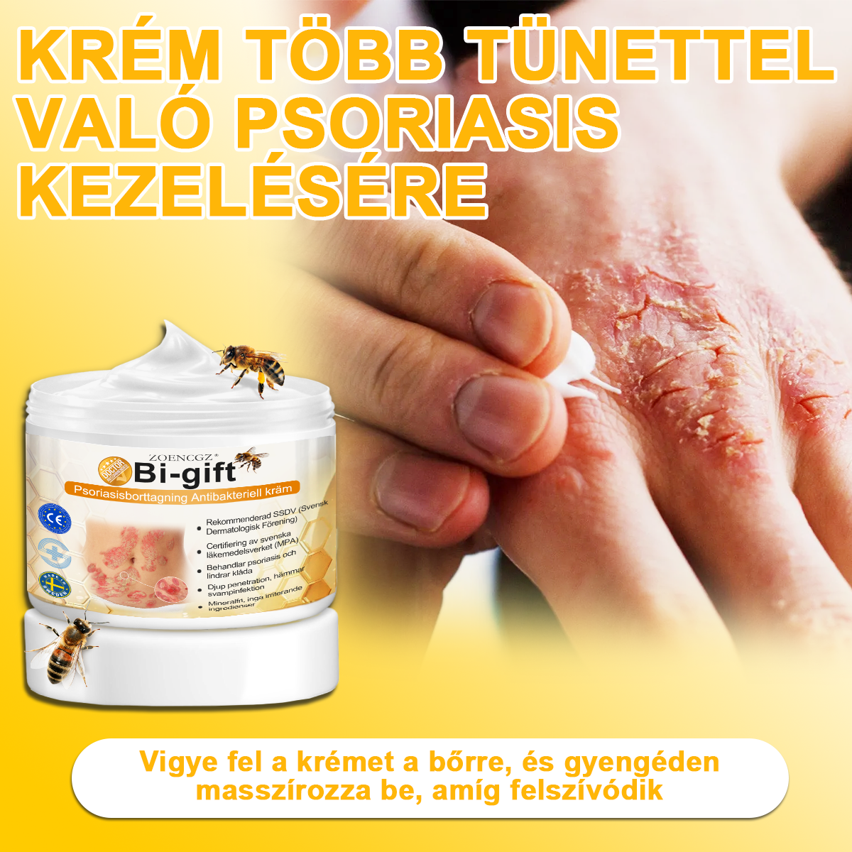 đ©ââïžđZoencgzâą mĂ©hmĂ©reg pikkelysömör eltĂĄvolĂtĂł krĂ©mđ„ (Az SSDV Skin Institute ajĂĄnlĂĄsa)
