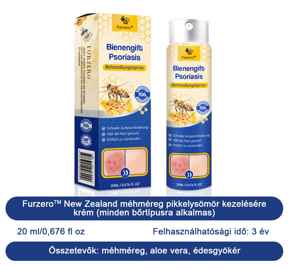 đšââFurzeroâą Psoriasis Treatment Spray-t a viszketĂ©s Ă©s a gyulladĂĄs csökkentĂ©se Ă©rdekĂ©ben 2 hĂ©t utĂĄn. (Dr. KĂĄrolyi Krisztina: hiteles ajĂĄnlĂĄs)