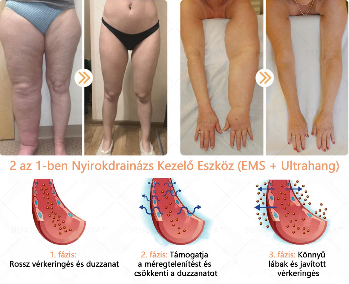 SIENOVA™💎 Hordozható nyirokeltető és ízületi relaxációs készülék👨⚕️ Eredeti 2 az 1-ben terápia | OGYEI minősített