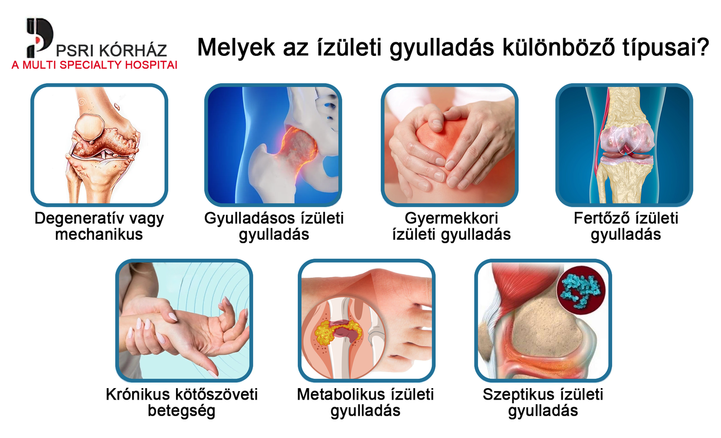 LOVILDS™ méhméreg és kurkuma ízületi gyulladás terápiás krém (👩🔬Ortopédiai betegségekre és ízületi fájdalmakra specializálódott👩🔬)