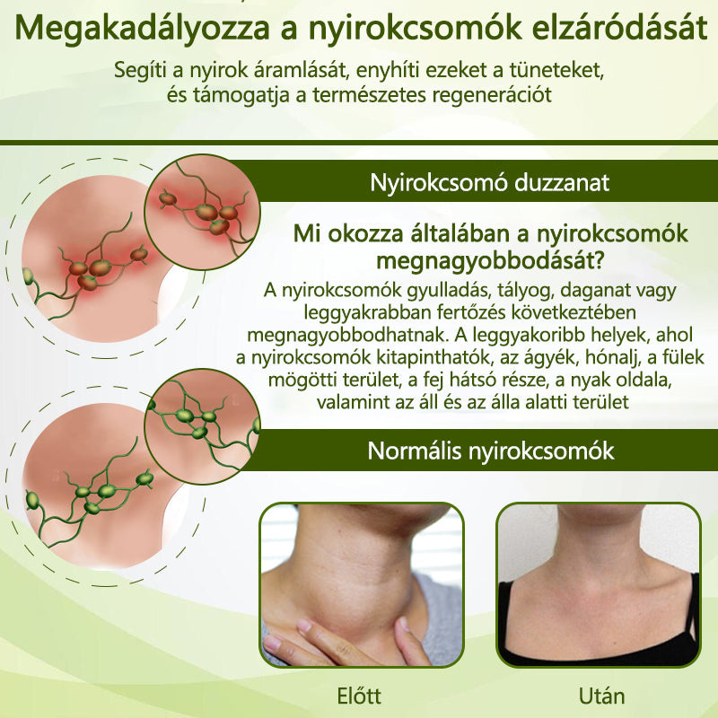 Croaie® SwellFree Mondj búcsút a duzzadt lábaknak és a visszér okozta kellemetlenségeknek – Természetesen!✅