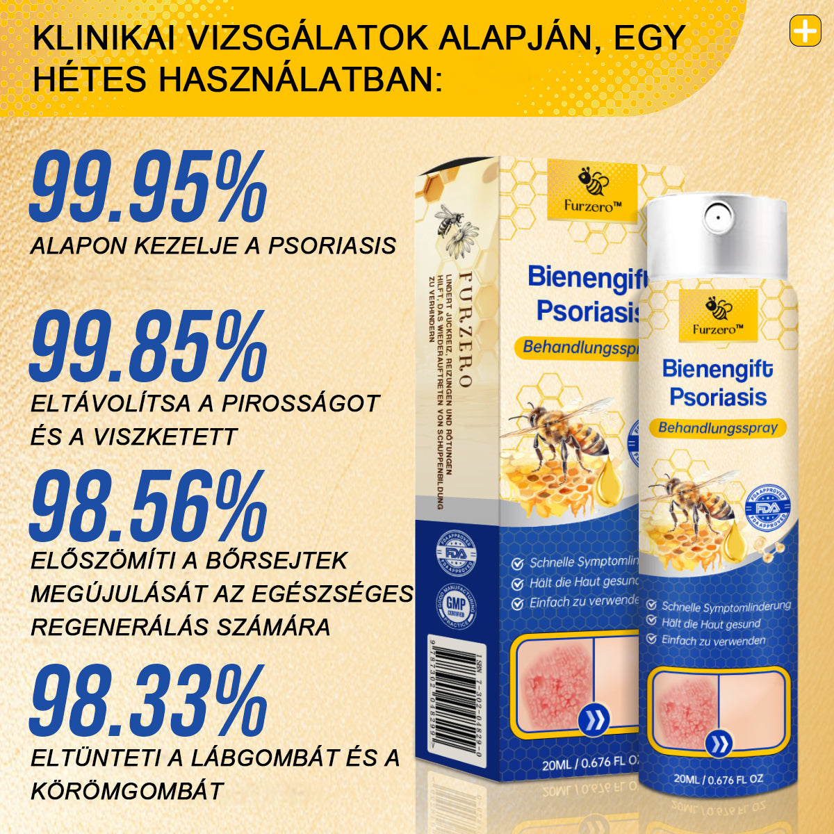 đšââFurzeroâą Psoriasis Treatment Spray-t a viszketĂ©s Ă©s a gyulladĂĄs csökkentĂ©se Ă©rdekĂ©ben 2 hĂ©t utĂĄn. (Dr. KĂĄrolyi Krisztina: hiteles ajĂĄnlĂĄs)
