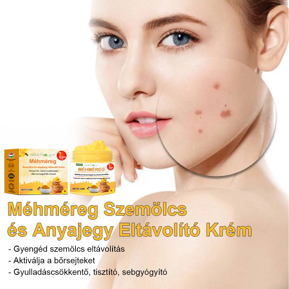 🍯👑BENETURE™ méhméreg szemölcs és anyajegy eltávolító krém (Utolsó napi akció, 80% kedvezmény)