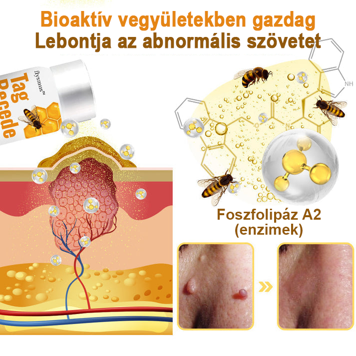 đđMĂ©hmĂ©reg szemölcs Ă©s övsömör eltĂĄvolĂtĂł spray (đšââAAD AjĂĄnlott) đ„(đ„Last Day 80% Off)