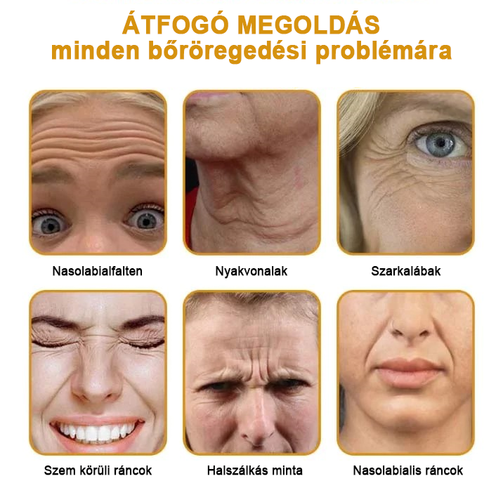 🍀Akció utolsó napja: 70% kedvezmény - ✨Furzero™ méhméreg ránctalanító krém