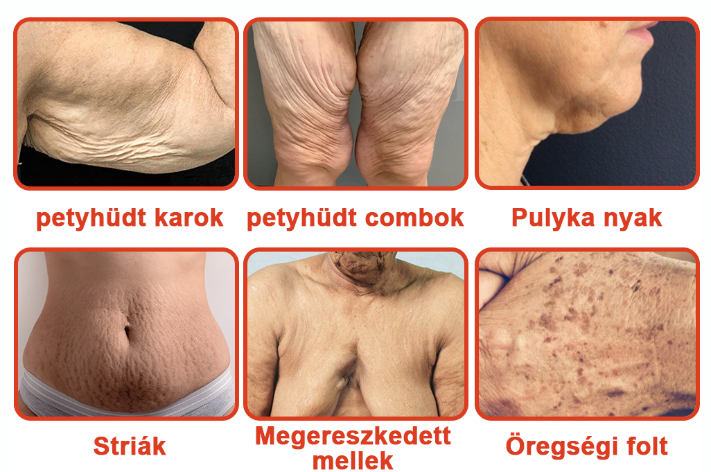 STDEI™ MÁGIKUS LUXUS TESTOLAJ (Korlátozott ideig 80% kedvezmény - Utolsó 30 perc)🌹🔥