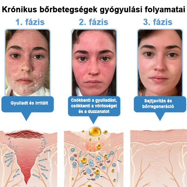 TODAHOF™✨ Multi-Symptoms krém méhméreggel (👩⚕️ az EMA ajánlásával)