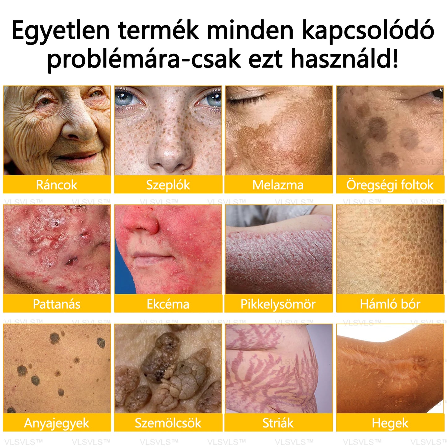 💐🌟💐Magyarországon készült és szállítva✨ VLSVLS® Méhméreg Bőrjavító Krém🔥 Utolsó nap 80% kedvezmény