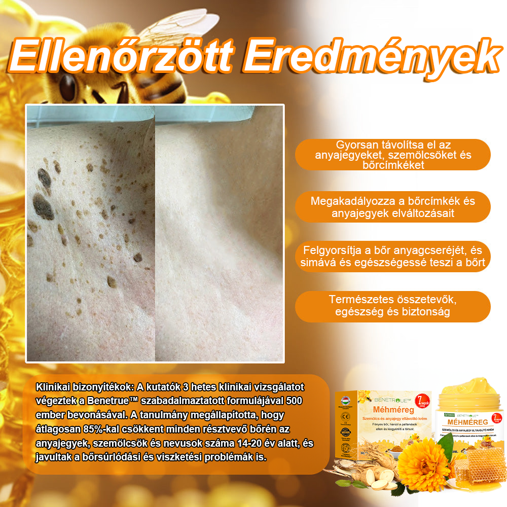 🍯👑BENETURE™ méhméreg szemölcs és anyajegy eltávolító krém (Utolsó napi akció, 80% kedvezmény)