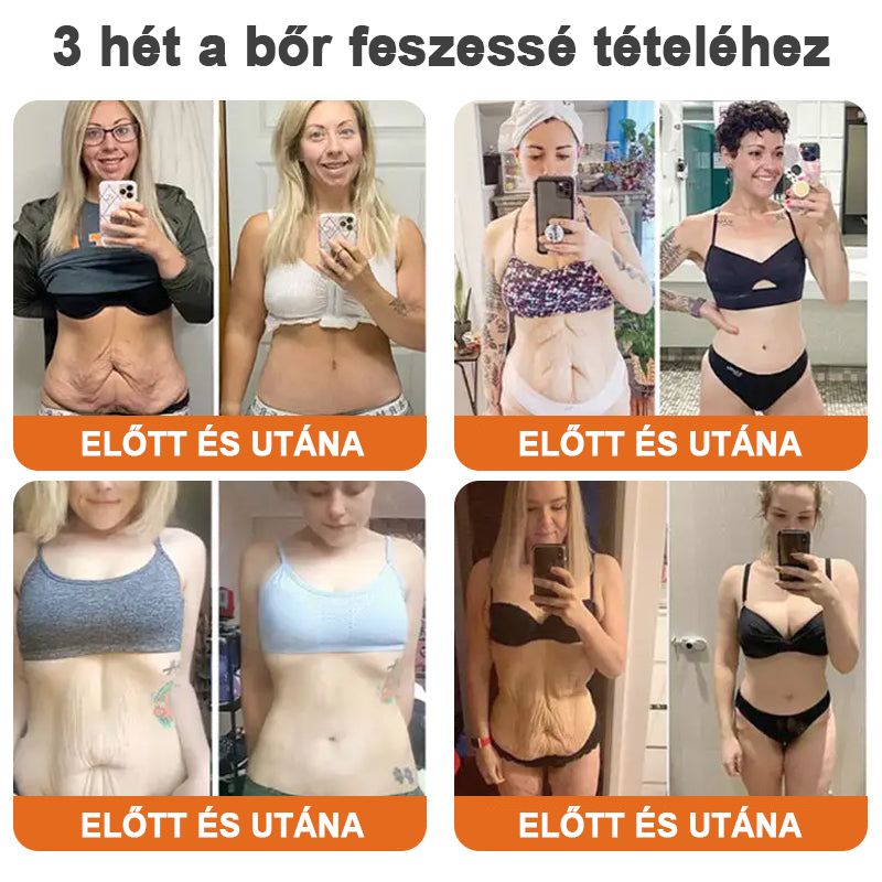 ✨Flysmus™ szérum botox méhméreggel való feszesítéshez🔥UTOLSÓ NAP 70% KEDVEZMÉNY