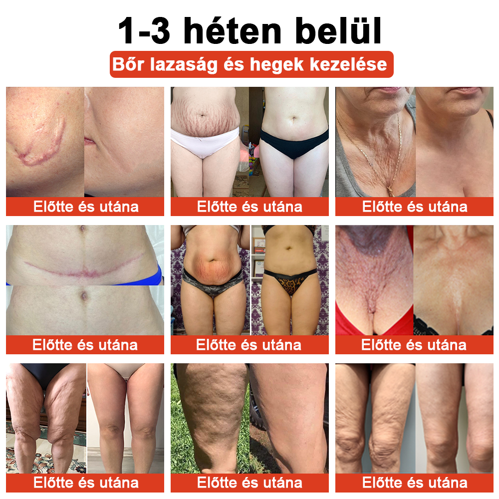 STDEI™ MÁGIKUS LUXUS TESTOLAJ (Korlátozott ideig 80% kedvezmény - Utolsó 30 perc)🌹🔥