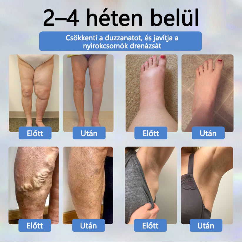 💧ATTDX® Növényi ödéma enyhítő krém nigellával