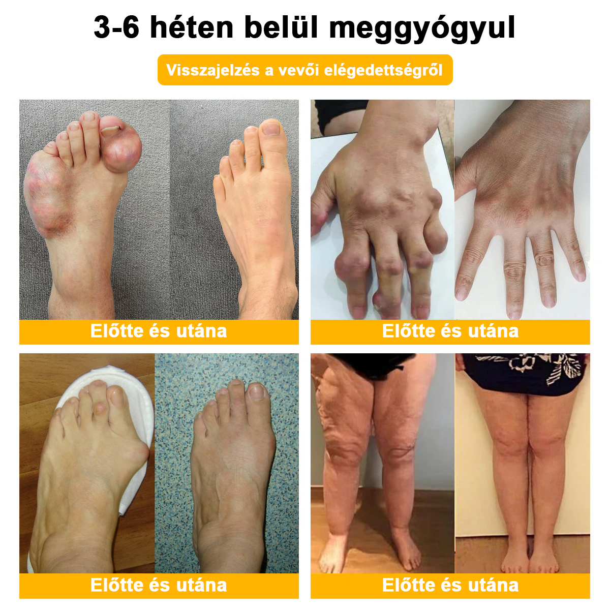 LOVILDS™ méhméreg és kurkuma ízületi gyulladás terápiás krém (👩🔬Ortopédiai betegségekre és ízületi fájdalmakra specializálódott👩🔬)