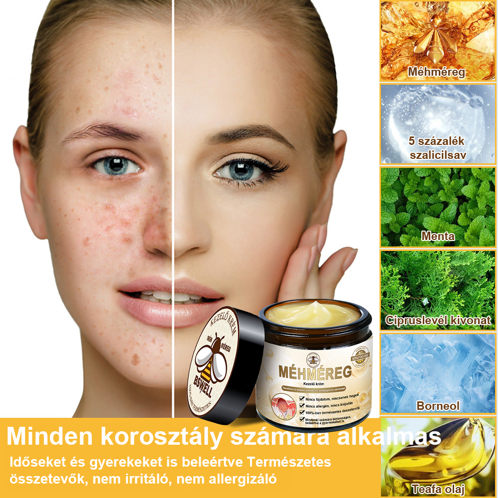 🐝✨𝑩𝑺𝑾𝑬𝑳𝑳® 𝑴é𝒉𝒎é𝒓𝒆𝒈 𝑲𝒆𝒛𝒆𝒍é𝒔 𝑲𝒓é𝒎👨⚕️(𝑫𝒆𝒓𝒎𝒂𝒕𝒐𝒍ó𝒈𝒖𝒔 𝒂𝒋á𝒏𝒍á𝒔𝒐𝒌) (🔥𝒖𝒕𝒐𝒍𝒔ó 𝒏𝒂𝒑 𝒑𝒓𝒐𝒎ó𝒄𝒊ó 80% 𝒌𝒊)