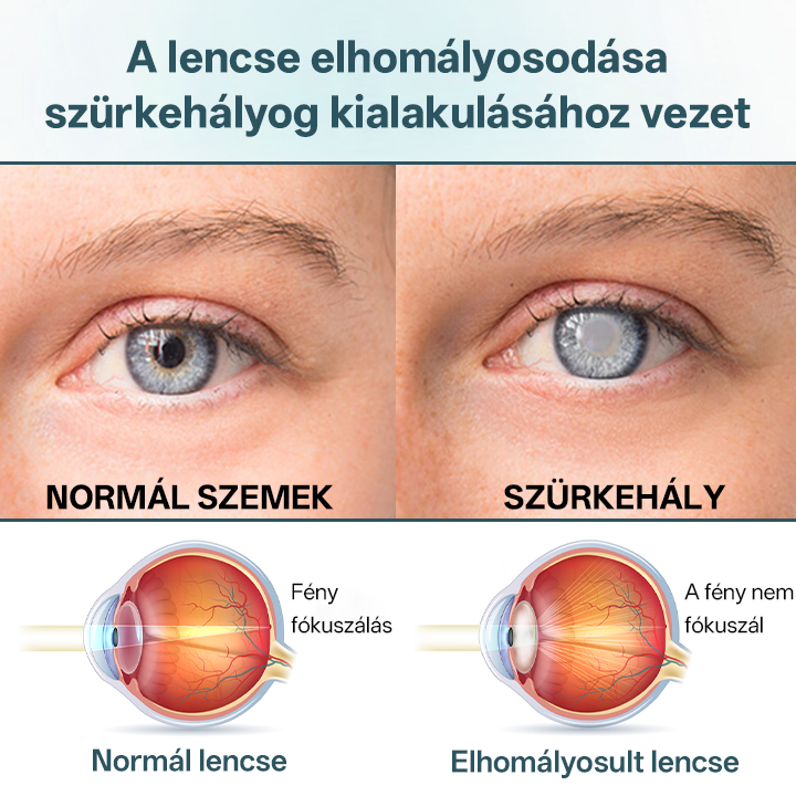 Timilk® OptiFusion Nano szemcsepp szérum🪞