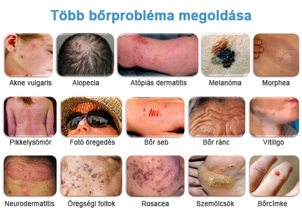TODAHOF™✨ Multi-Symptoms krém méhméreggel (👩⚕️ az EMA ajánlásával)