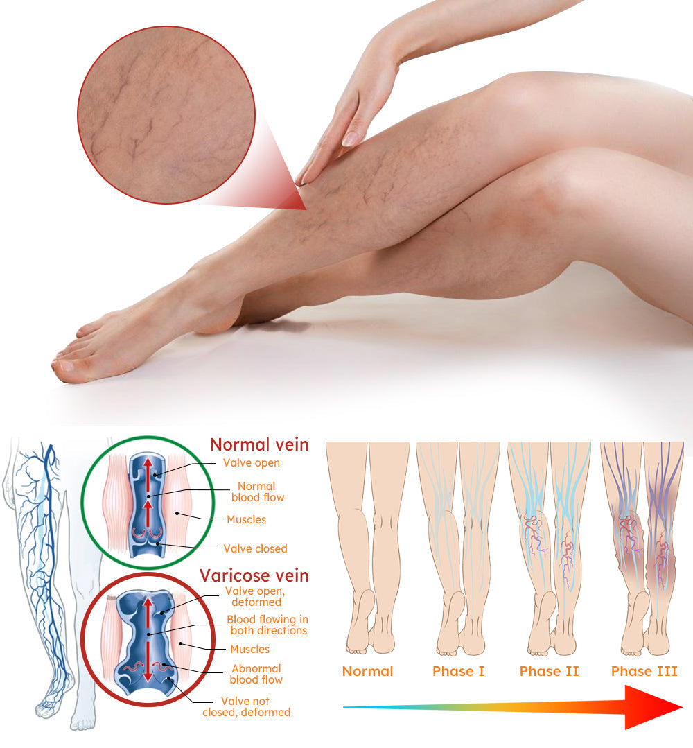 đ©ââïžFurzeroâą kurkuma visszĂ©r tapasz(Az SSDV Skin Institute ajĂĄnlĂĄsa)