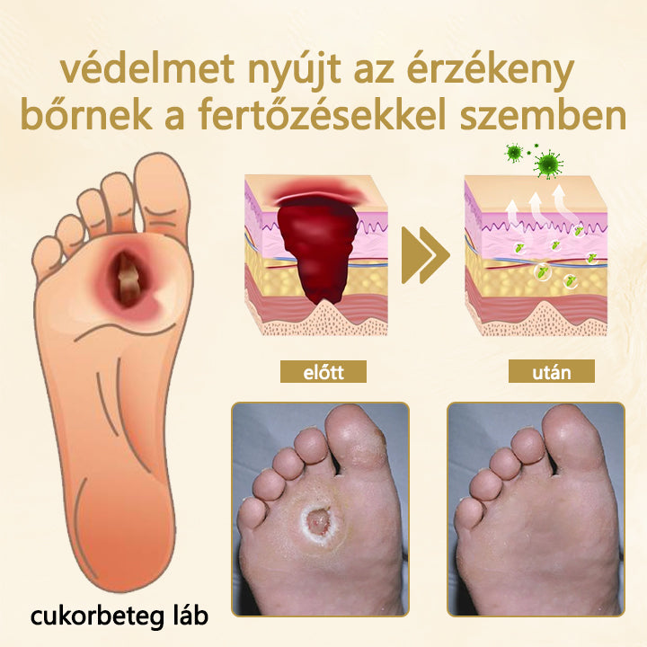 Cvreoz® méhméreg gyógyító spray a sebek gyógyulására és regenerálására a kezeken és a lábakon🎉