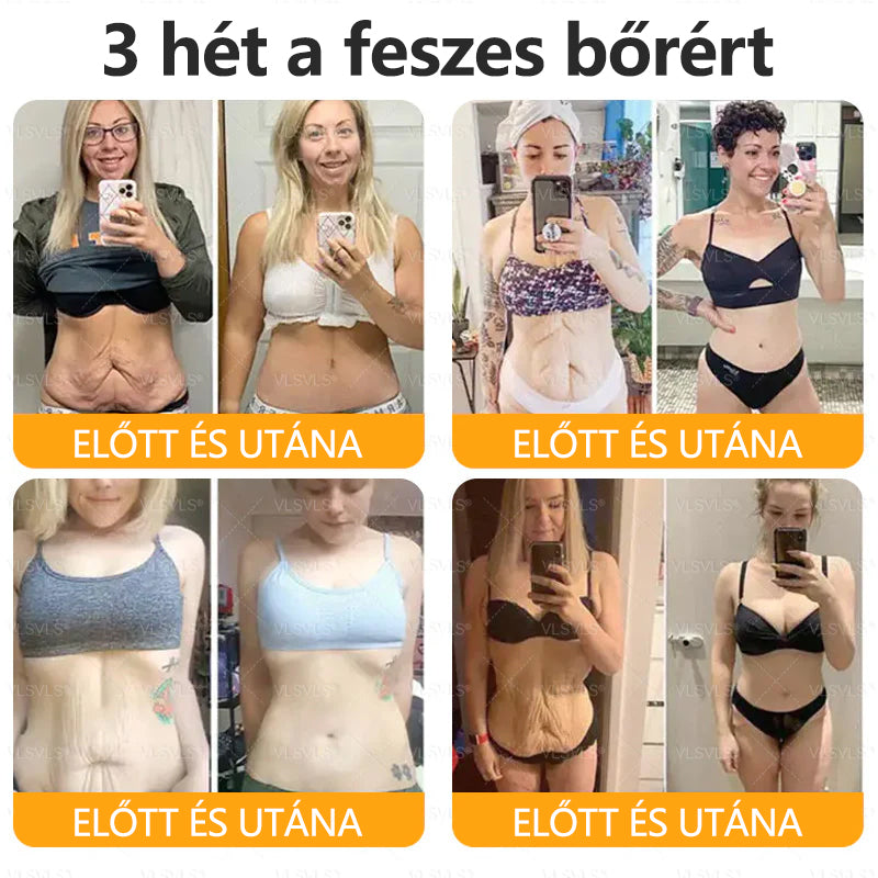 💐🌟💐Magyarországon készült és szállítva✨ VLSVLS® Méhméreg Bőrjavító Krém🔥 Utolsó nap 80% kedvezmény