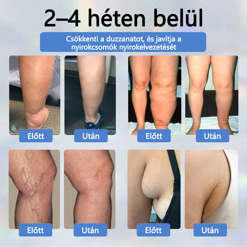 💧ATTDX® Növényi ödéma enyhítő krém nigellával