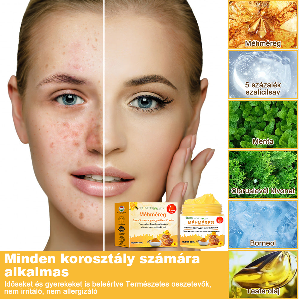 🍯👑BENETURE™ méhméreg szemölcs és anyajegy eltávolító krém (Utolsó napi akció, 80% kedvezmény)