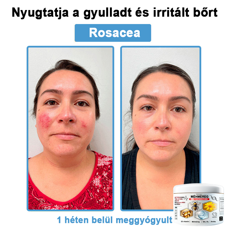 TODAHOF™✨ Multi-Symptoms krém méhméreggel (👩⚕️ az EMA ajánlásával)