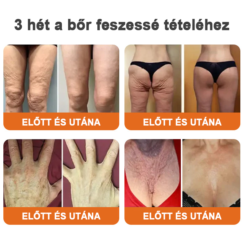 ✨Flysmus™ szérum botox méhméreggel való feszesítéshez🔥UTOLSÓ NAP 70% KEDVEZMÉNY