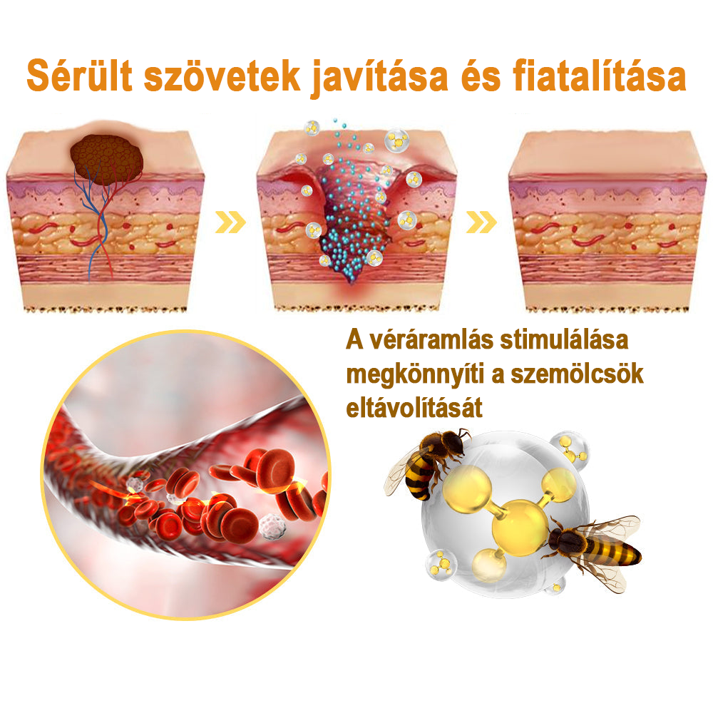 đđMĂ©hmĂ©reg szemölcs Ă©s övsömör eltĂĄvolĂtĂł spray (đšââAAD AjĂĄnlott) đ„(đ„Last Day 80% Off)