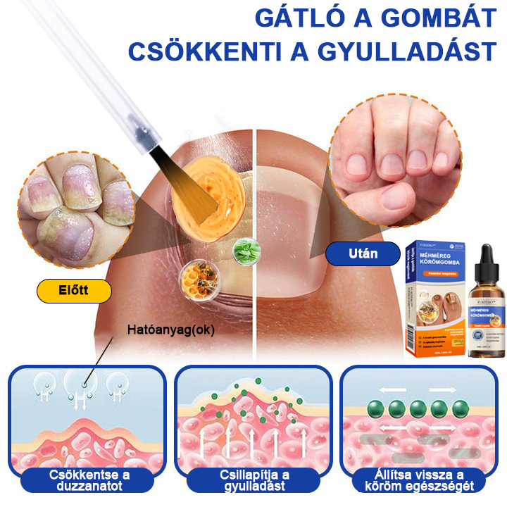 🐝🐝Furzero™ méhméreg körömgomba kezelési megoldás:Teljesen megoldja a körömgomba problémát🌟👣
