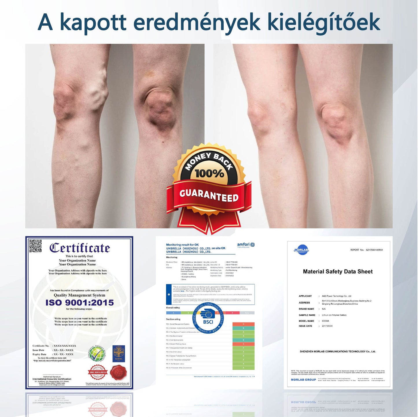 💧ATTDX® Növényi ödéma enyhítő krém nigellával