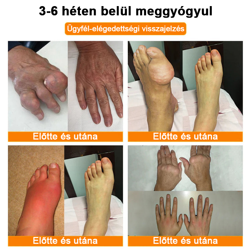 ✅Hivatalos Áruház: Ourlyard™ Magnézium Olaj és Méhméreg ízületjavító spray 👨⚕️ A Gyógyszerügyi Hivatal (OGYEI) jóváhagyásával🔥🔥🔥