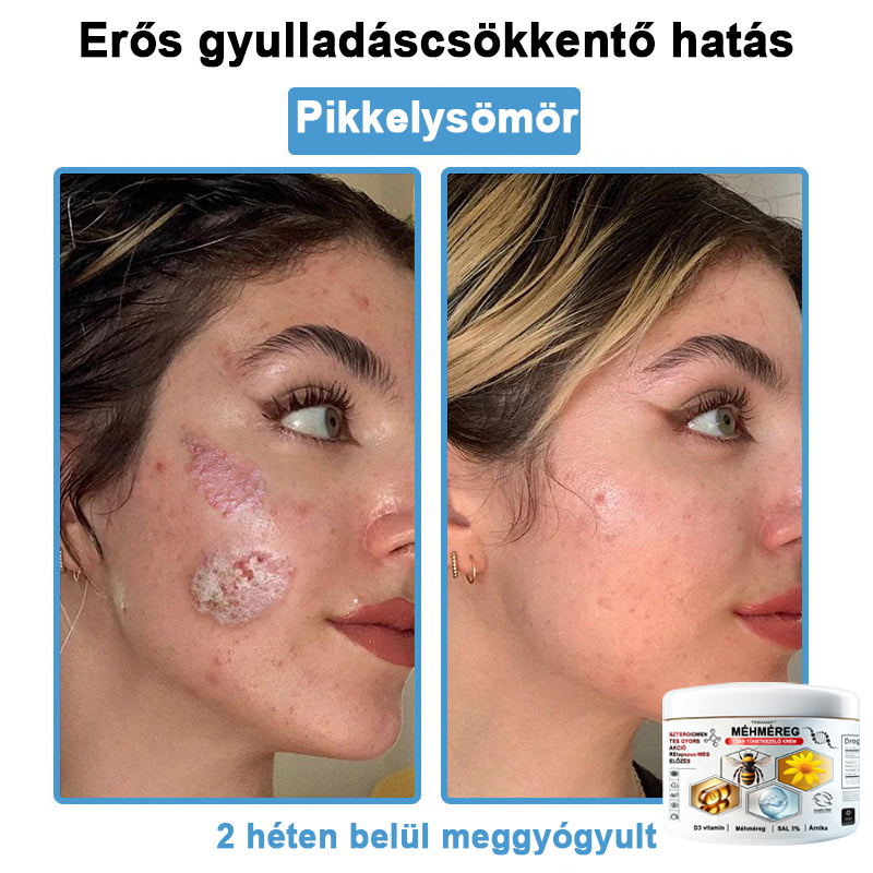 TODAHOF™✨ Multi-Symptoms krém méhméreggel (👩⚕️ az EMA ajánlásával)