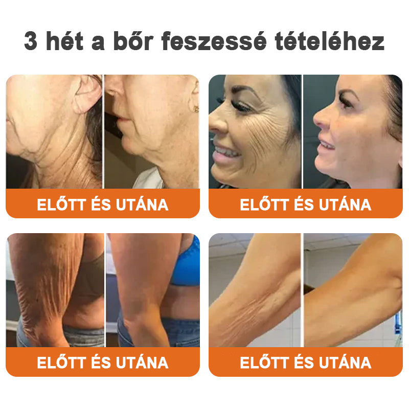 ✨Flysmus™ szérum botox méhméreggel való feszesítéshez🔥UTOLSÓ NAP 70% KEDVEZMÉNY